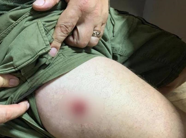 В місті Васильків стріляли через місце в цирку
