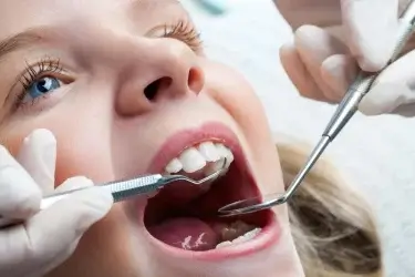Що таке стоматологічний Check-Up та кому він потрібен?